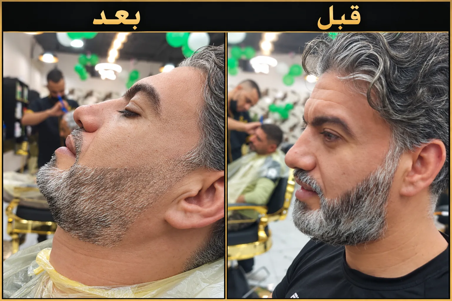 قبل وبعد: تحديد دقن وتهذيب شعر لأحد عملاء رويال تاتش